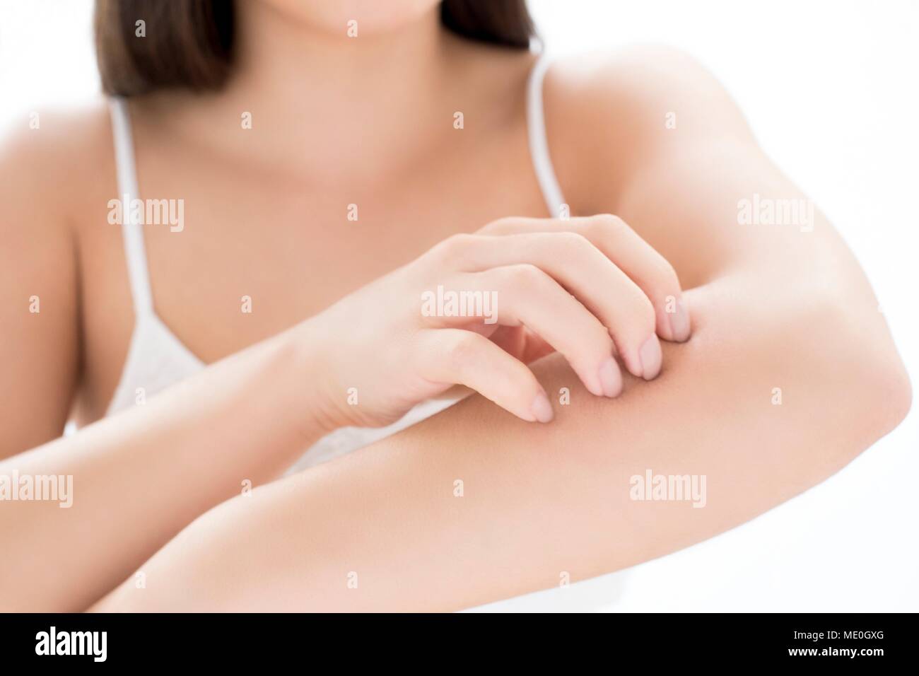 Mujer joven rascarse el brazo. Foto de stock