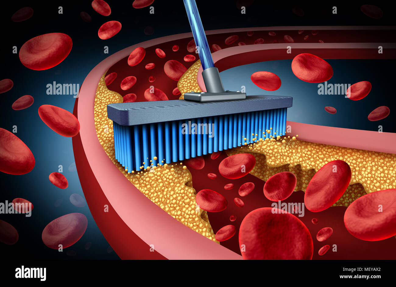 El tratamiento de la medicina de quelación y terapia alternativa para enfermedades del corazón humano el concepto de la circulación de la sangre enfermedad con ilustración 3D elementos. Foto de stock