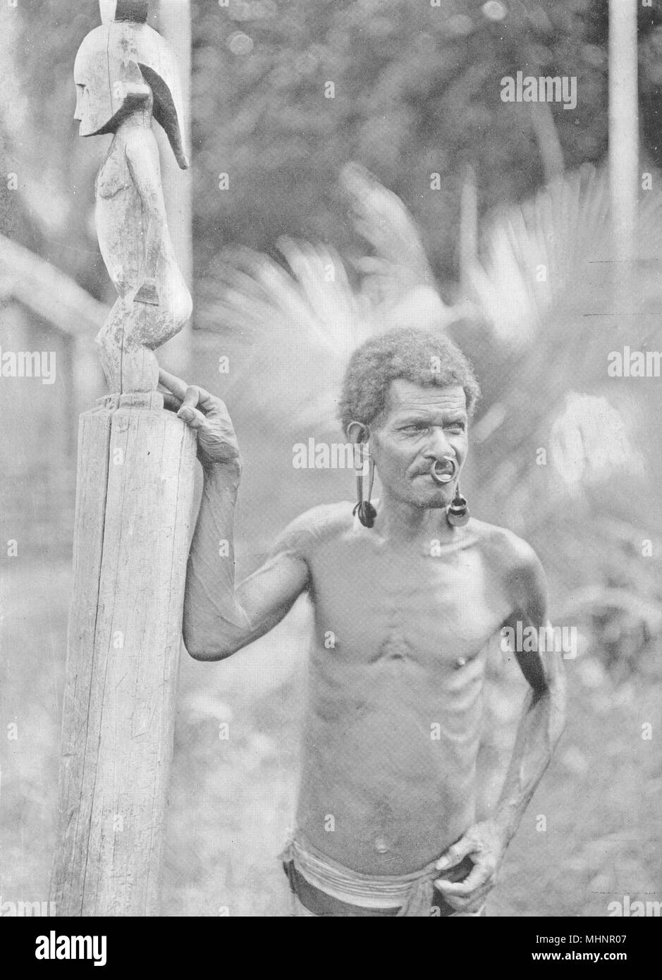 La melanesia. Malformación de oídos; un hombre Islas Salomón 1900 impresión antigua Foto de stock