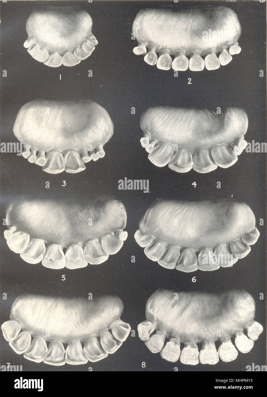 La edad de los bueyes. La dentadura. Incisivos a diversas edades 1912 antigüedades imprimir Foto de stock