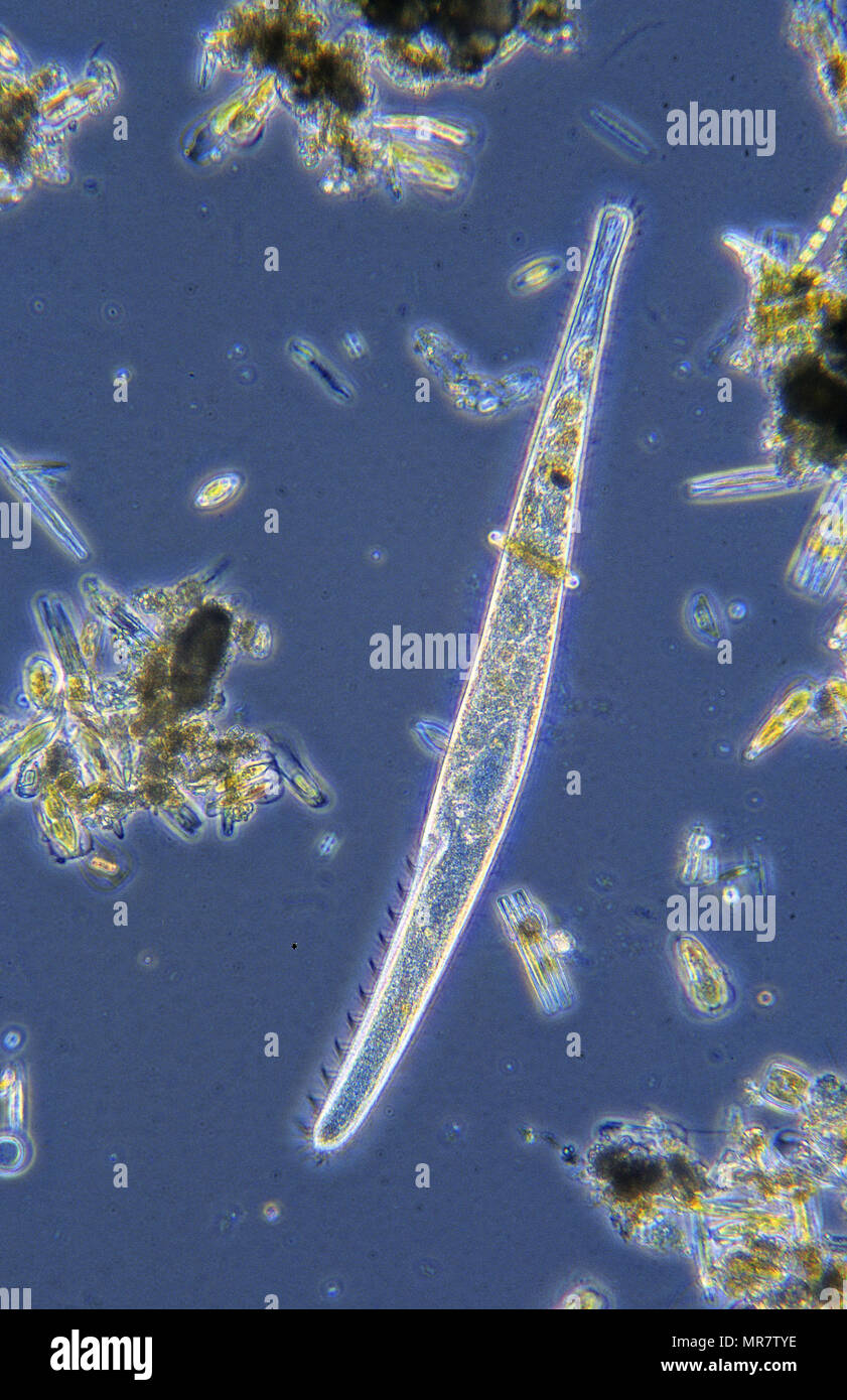 Spirostomum.Ciliata.protozoos.microscopia óptica Foto de stock