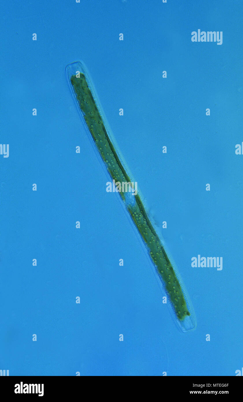 Nitzscjoa.Diatomea.Seawed.algas.microscopia óptica Foto de stock