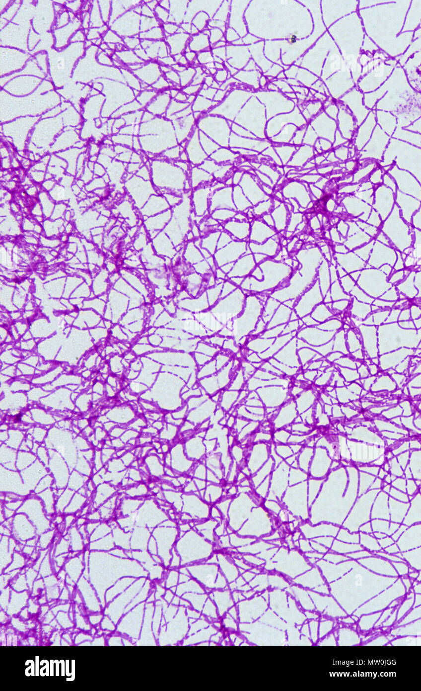 Bacillus anthracis.Bactery de ántrax.Gram Foto de stock