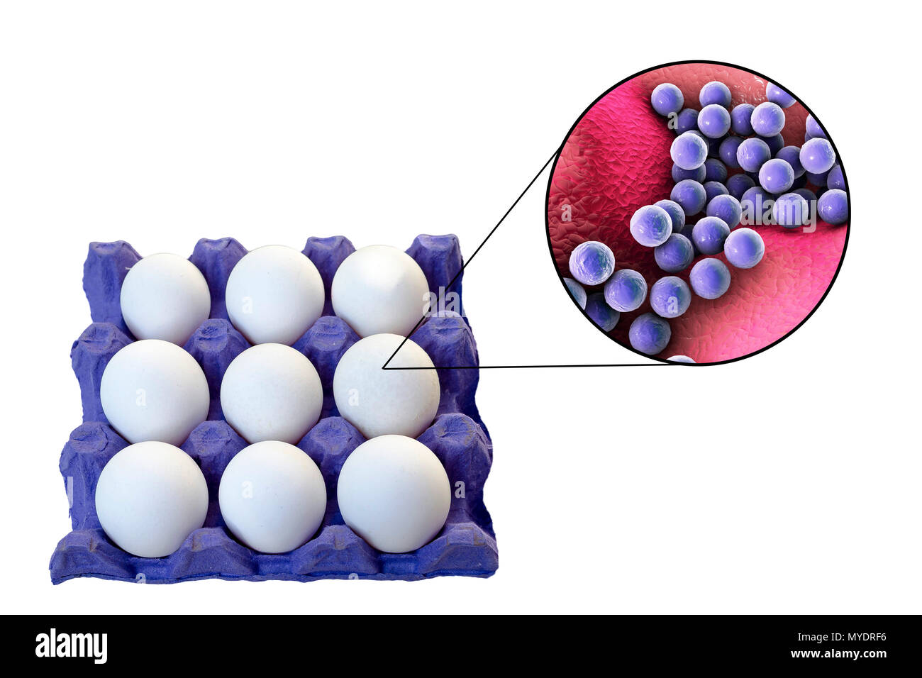 Los huevos de pollo como fuente de intoxicación alimentaria por estafilococos, Ilustración conceptual. Foto de stock