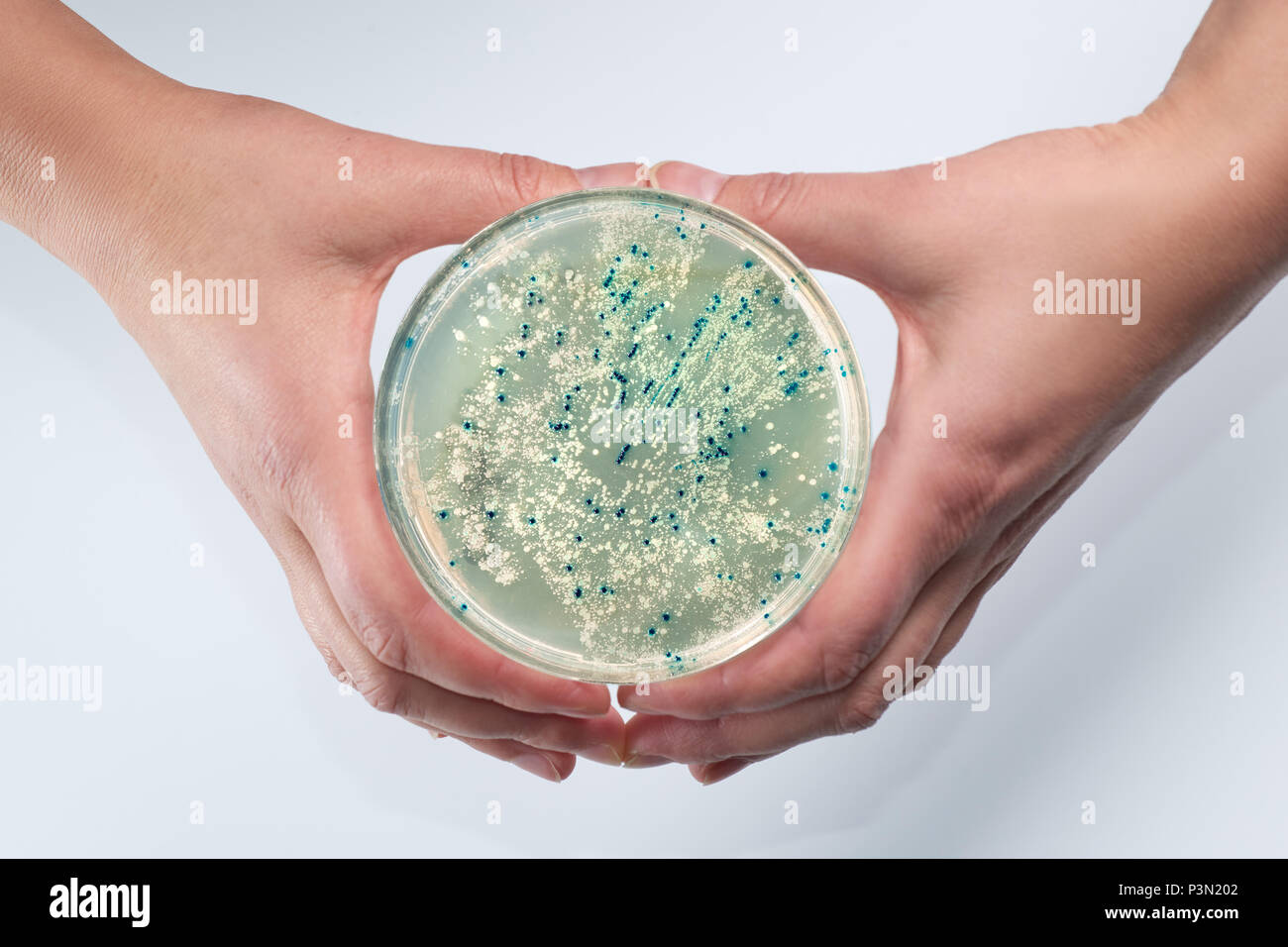 Mujeres manos sosteniendo una caja de Petri con colonias bacterianas de agar-agar. Selección azul-blanco de E.coli para detectar inserciones de vector construir en un Foto de stock