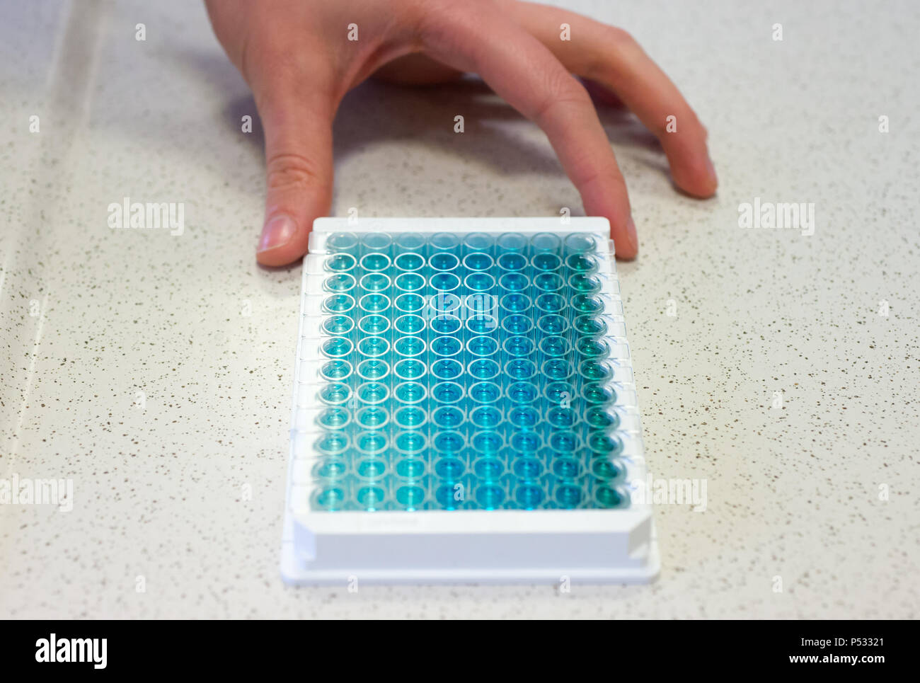 Trabajo de laboratorio: Muestras en una placa de PCR de 96 pocillos en el ELISA-diagnóstico Foto de stock