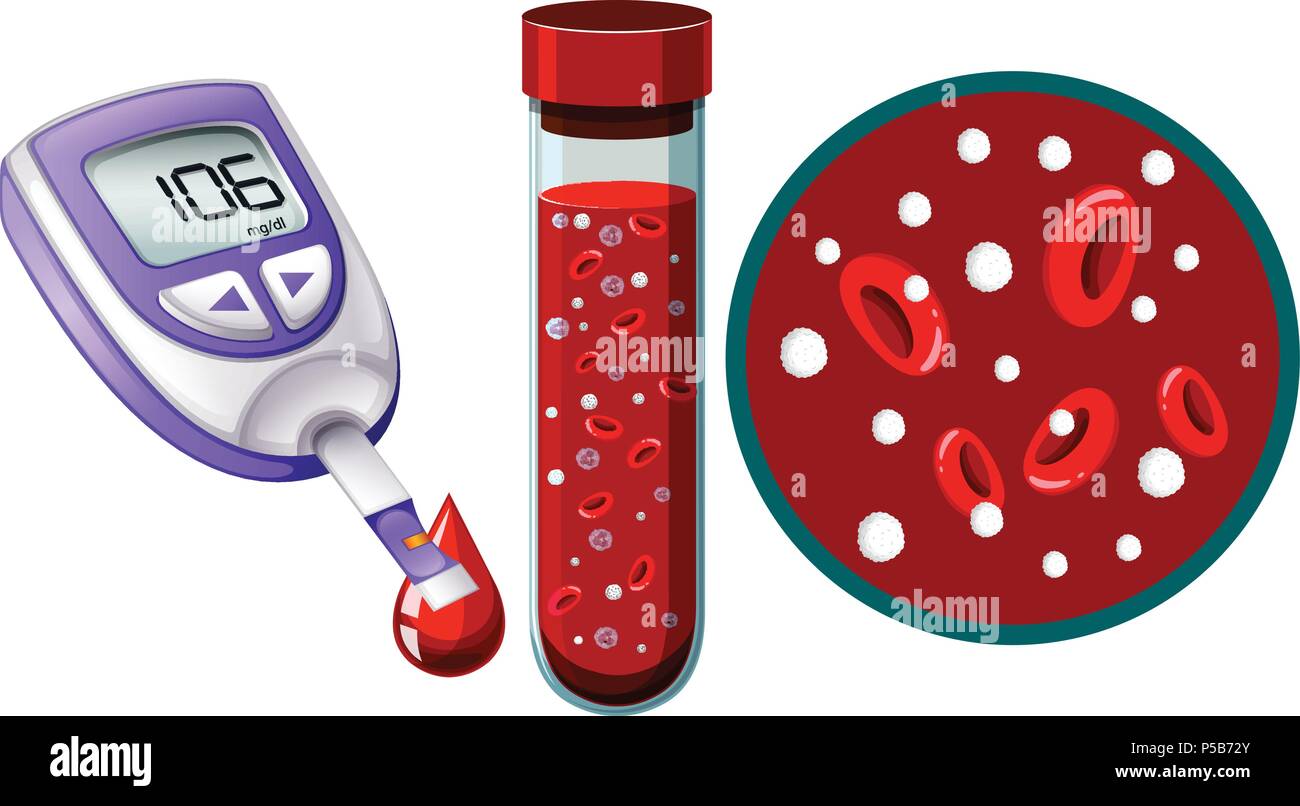 Prueba de sangre y el dispositivo de monitoreo de glucosa en la ilustración  Imagen Vector de stock - Alamy