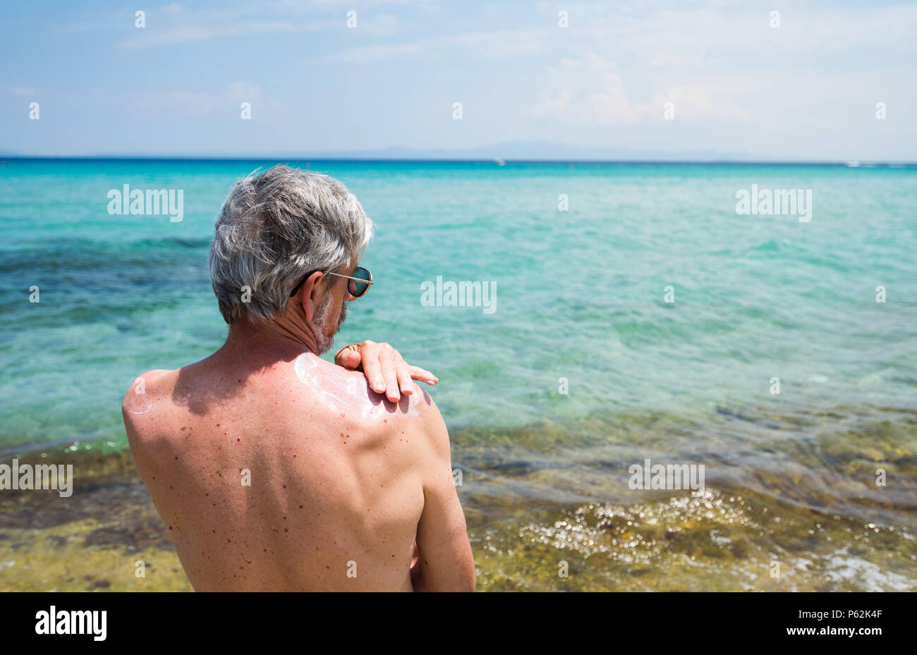 Hombre senior con crema de protección solar en las vacaciones de verano Foto de stock