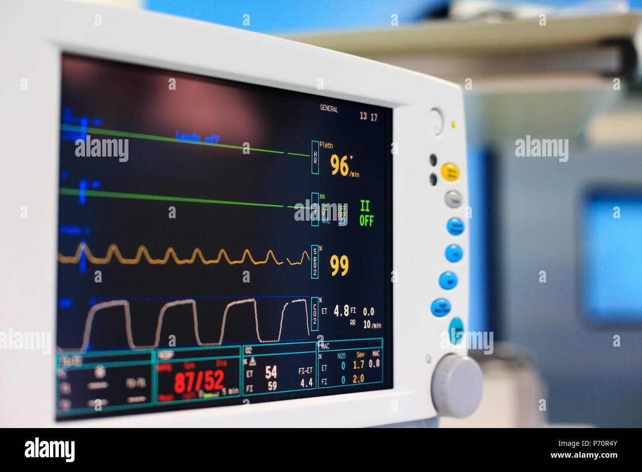 Monitor de signos vitales en el quirófano Fotografía de stock - Alamy