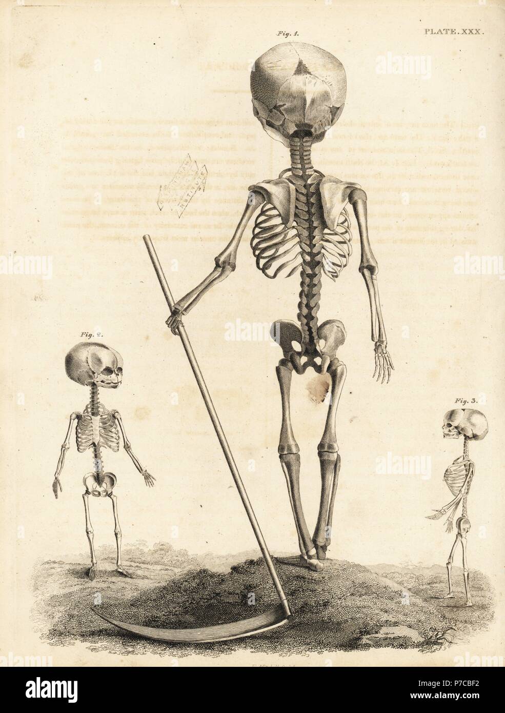 Esqueleto fetal en seis meses con la guadaña 1, en tres meses y de 2 a 10 semanas 3. Copperplate grabado por Edward Mitchell después de una ilustración anatómica por Jean-Joseph Sue de John Barclay's una serie de grabados del esqueleto humano MacLachlan, y Stewart, Edimburgo, 1824. Foto de stock