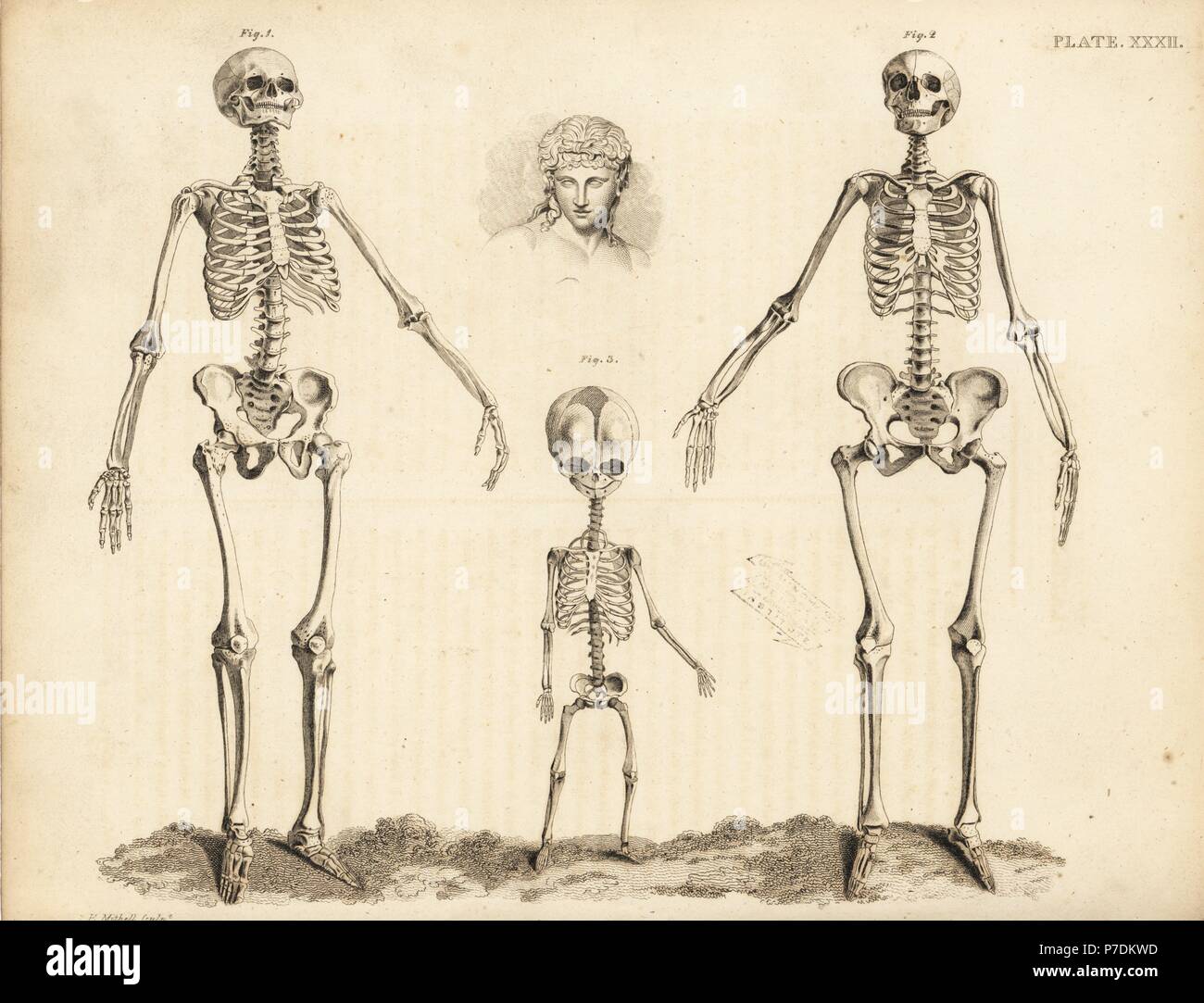 Comparación de los esqueletos de los derechos de hombres, de mujeres y al feto durante el parto. Copperplate grabado por Edward Mitchell después de una ilustración anatómica por Jean-Joseph Sue de John Barclay's una serie de grabados del esqueleto humano MacLachlan, y Stewart, Edimburgo, 1824. Foto de stock
