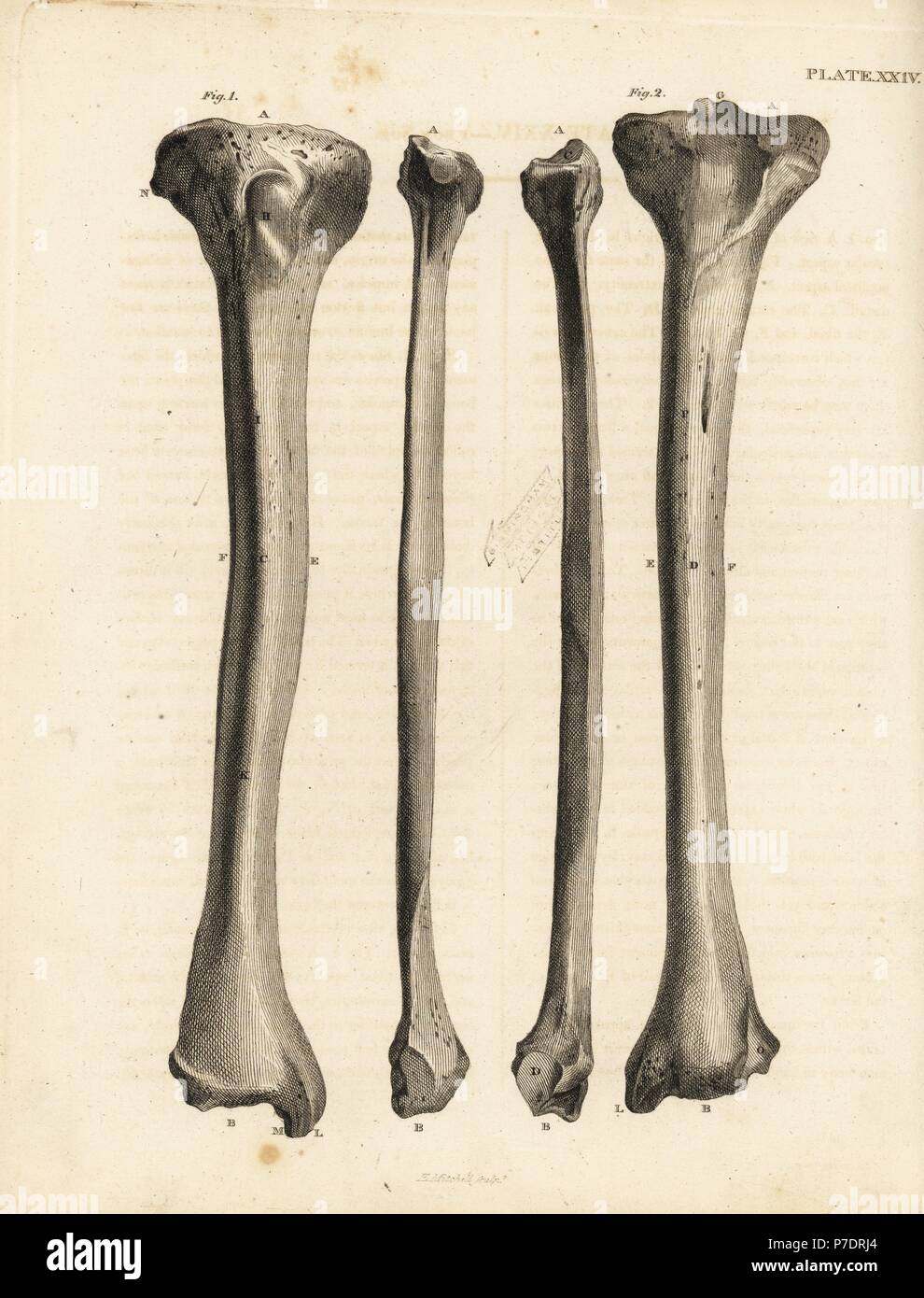 Opiniones de los huesos de la tibia en la pierna humana. Copperplate grabado por Edward Mitchell después de una ilustración anatómica por Jean-Joseph Sue de John Barclay's una serie de grabados del esqueleto humano MacLachlan, y Stewart, Edimburgo, 1824. Foto de stock
