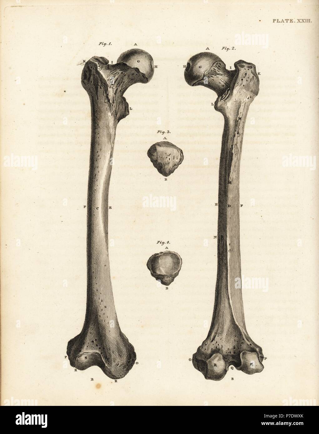Opiniones del fémur y rotula los huesos de la pierna humana. Copperplate grabado por Edward Mitchell después de una ilustración anatómica por Jean-Joseph Sue de John Barclay's una serie de grabados del esqueleto humano MacLachlan, y Stewart, Edimburgo, 1824. Foto de stock