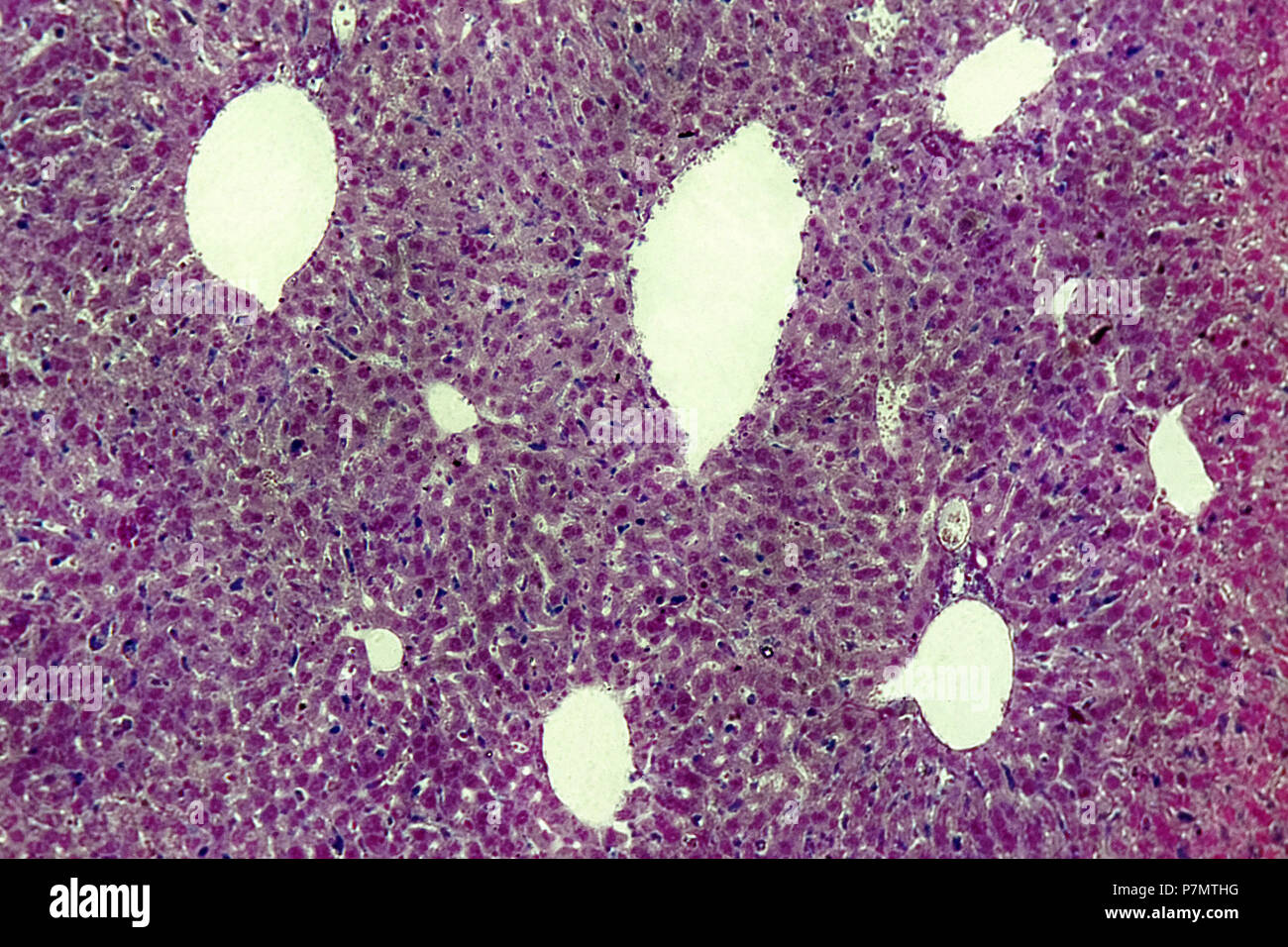 Sección transversal de hígado de Casa Oriental ratón (Mus musculus var. alba) Foto de stock