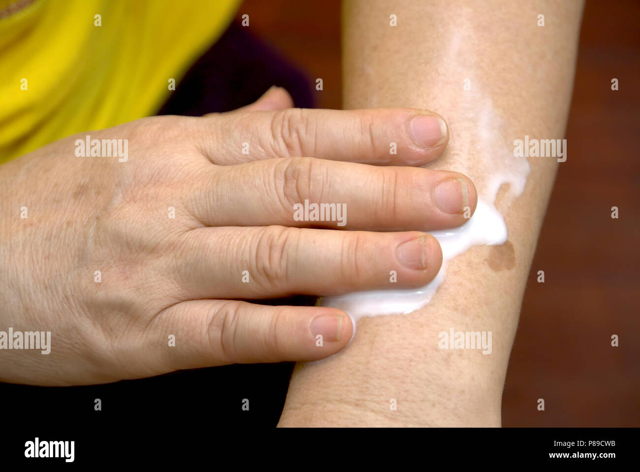 Las mujeres aplicar crema en el brazo. Foto de stock
