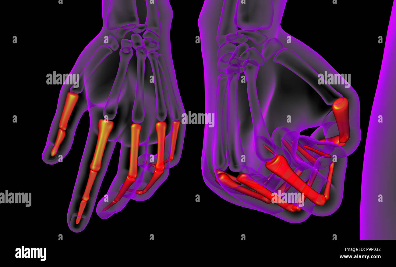 3D rendering ilustración médica del dedo hueso Foto de stock