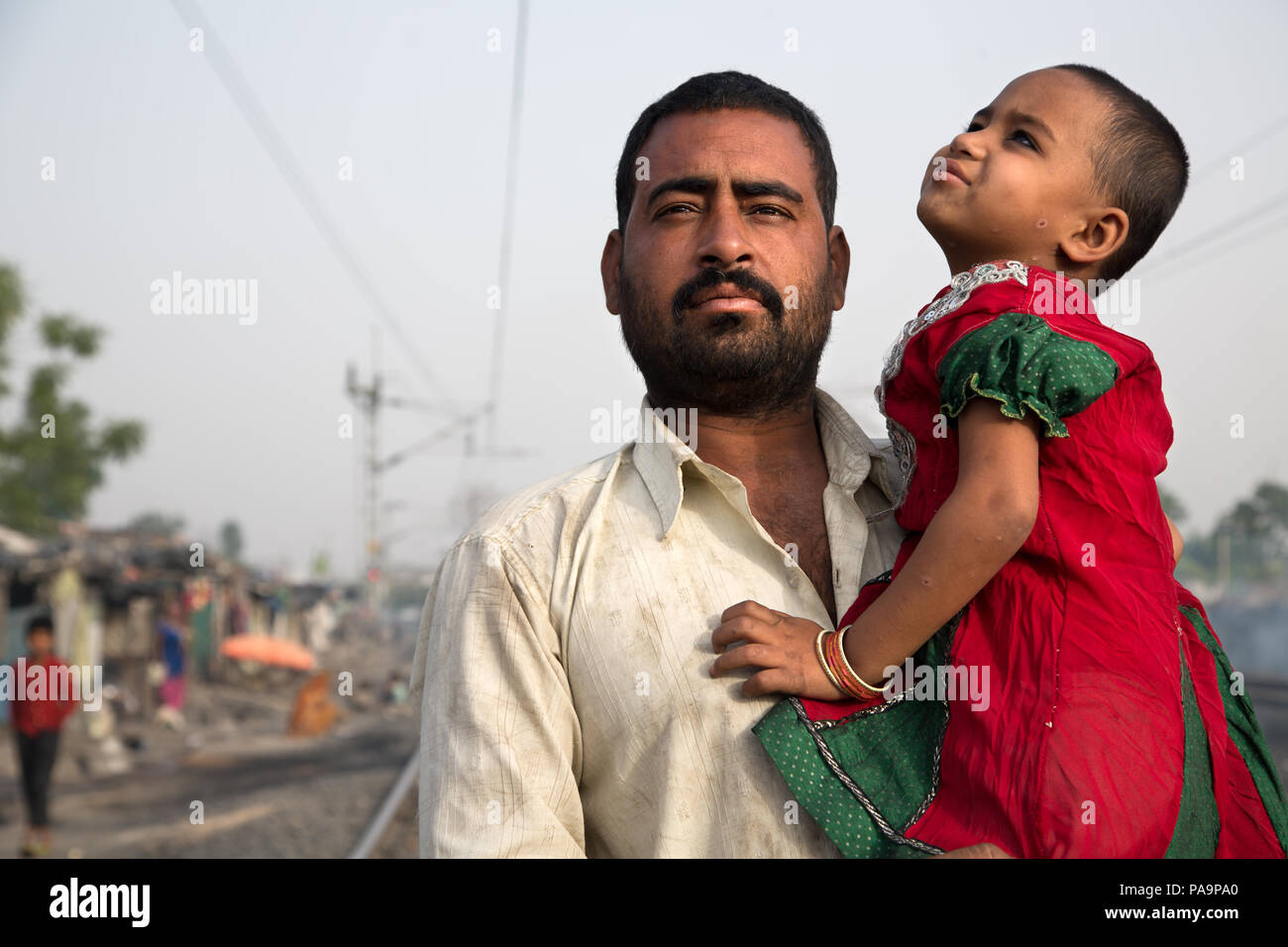 Padre y su hija discapacitada en Arif Nagar abandonados area, cerca del complejo industrial, Union Carbide en Bhopal, India Foto de stock