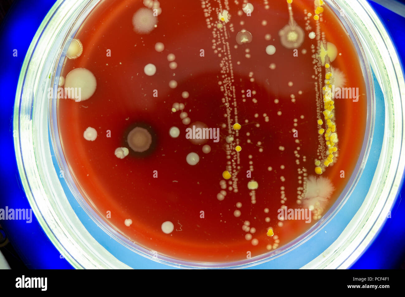 Placa de Petri con colonias de microbios Foto de stock