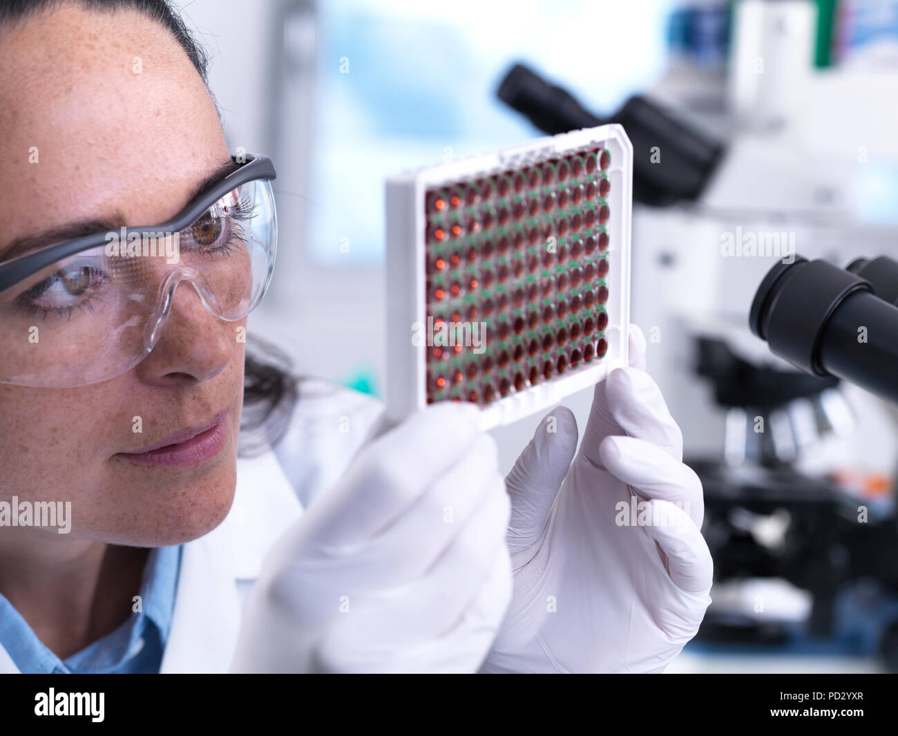 Scientist viendo una placa de pocillos múltiples que contienen las muestras de sangre para la detección de un laboratorio Foto de stock