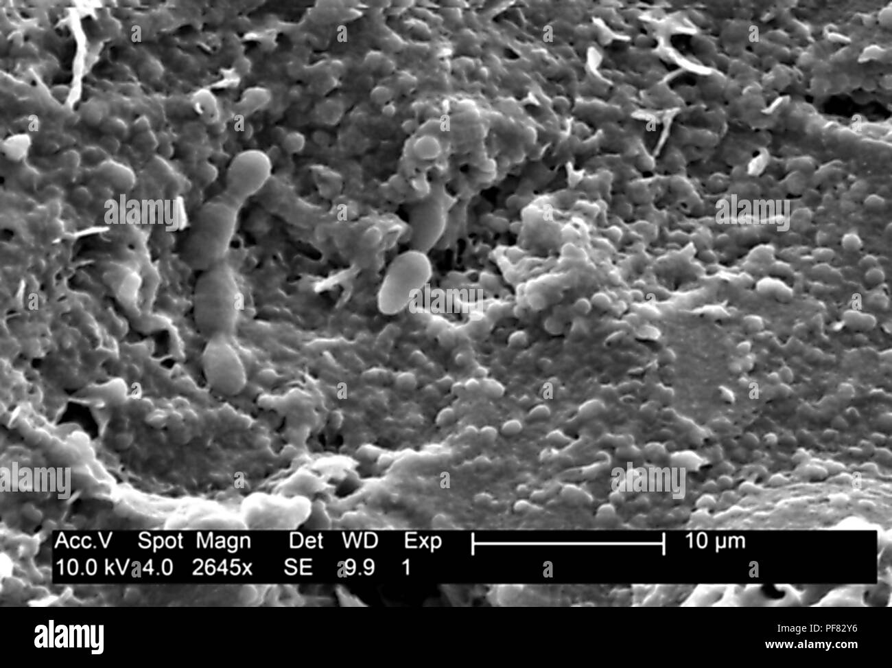 Textura de superficie se encontraron detalles sobre un melón honeydew (Cucumis melo), revelado en el 2645x magnificada electron micrograph film, 2004. Imagen cortesía de los Centros para el Control de Enfermedades (CDC). () Foto de stock