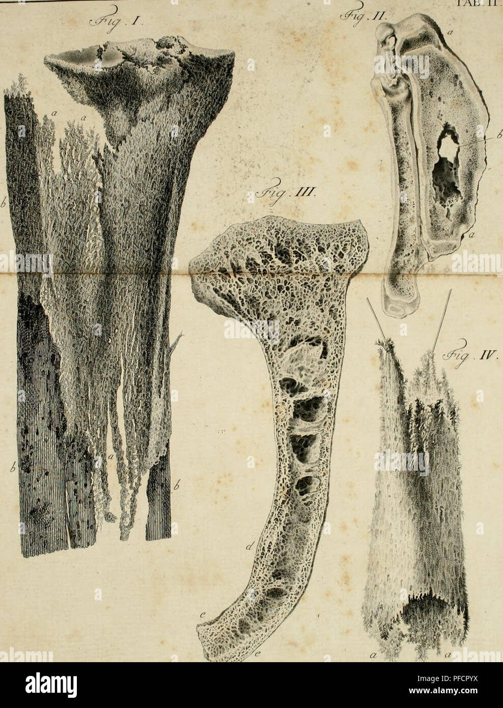 De Penitiori Ossium Commentarius Structura Hueso Y Huesos Embriologia Huesos Embriologia Tab Ii F Ic Erloni C E M Ef U P Por Favor Tenga En Cuenta Que Estas Imagenes Son Extraidas De La Pagina