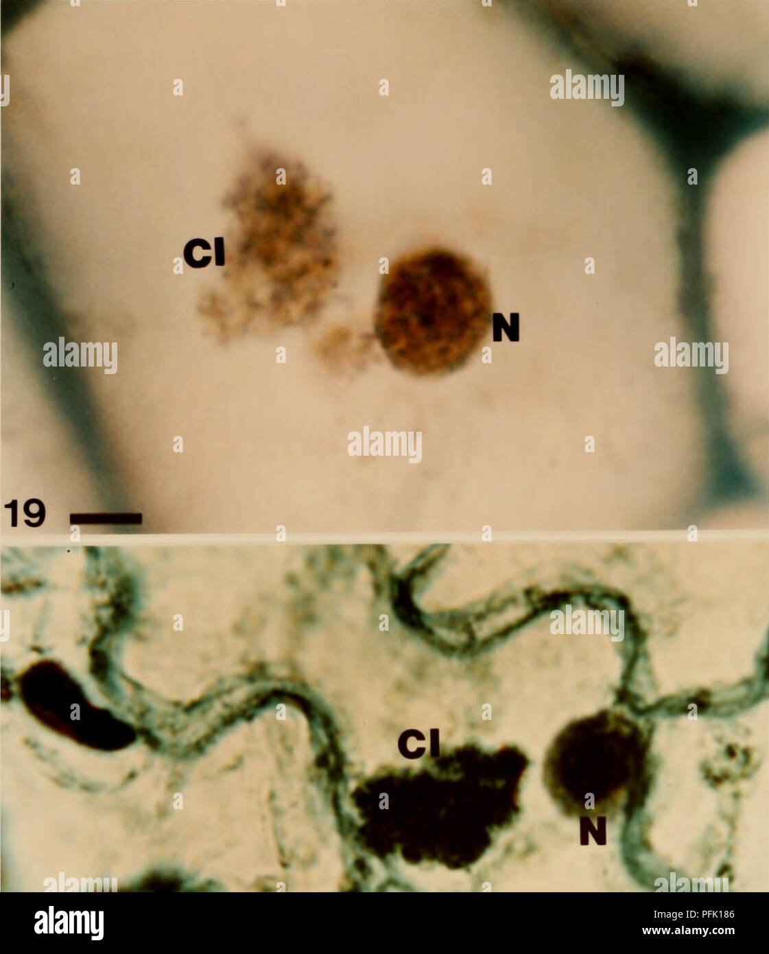 . Métodos citológicos para la detección, identificación y