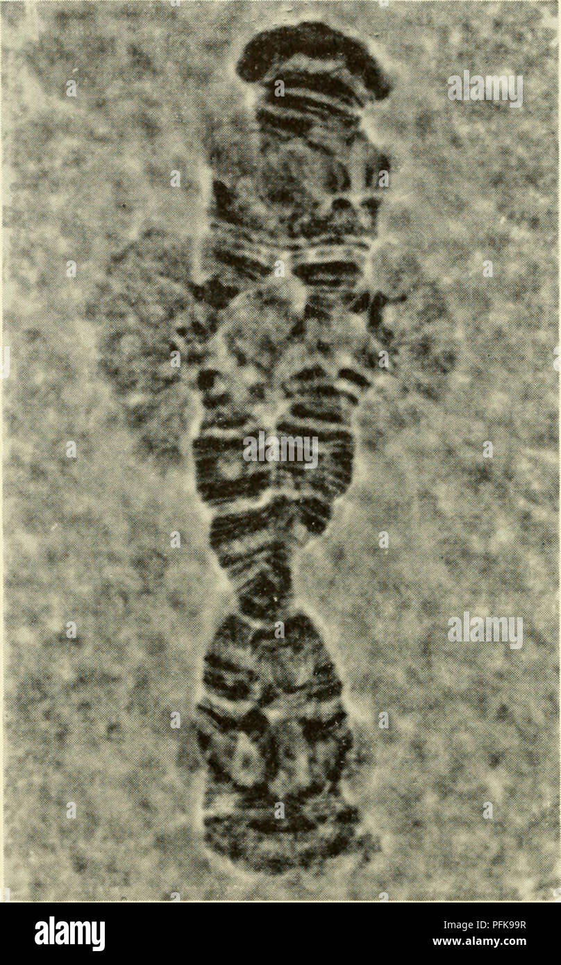 citología. La citología. Figura 4-19. Microfotografía cromosoma 4 de SaUvary tentans mostrando un gran anillo Balbiani y dos anillos más pequeños situados cerca de los extremos de terminal