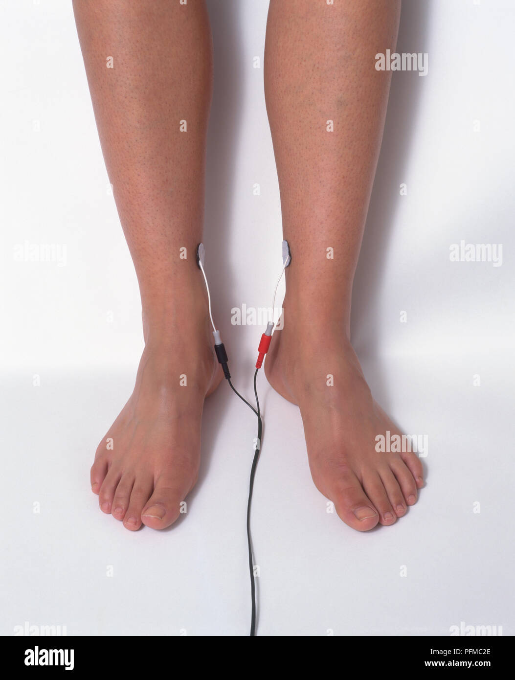 La TENS (estimulación nerviosa transcutánea) Electrónica de electrodos en  los tobillos de mujer Fotografía de stock - Alamy