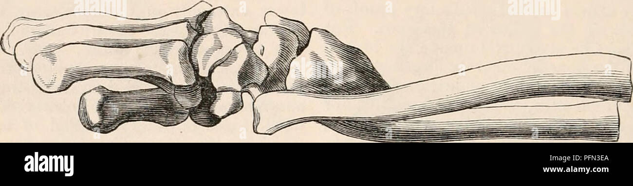 La cyclopaedia de anatomía y fisiología. Anatomía; fisiología; Zoología.  1520-JOINT de la muñeca (anatomía anormal^). extendido que antes; el dolor  desaparece, y en cerca de un mes después de la fractura,