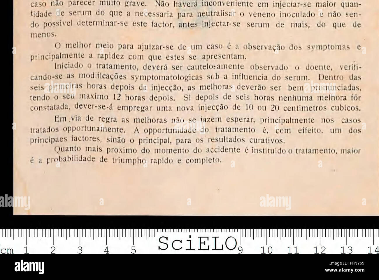 . Una defesa contra o ophidismo. 130 cm praso () que se pôde intervir utilmente vaiin naturalmente com un sobrevi- vencia que terios una victima, qual depende de vários factores, entre os quaes, oh mais importante é o constituído pela dosis de veneno inoculado. Nos casos em que un morte terios de dar-se em 12 horas un intervenção devera ser immediata ou dentro das primeiras horas após o accidente. Si ao cono. rio o caso é menos grave, tendo de dar-se o óbito 4S e mais horas depois do accidente. Un injecção ainda poderá ser util muitas horas depois. E' sempre mais seguro fazer- se una injecção de suero o m Foto de stock