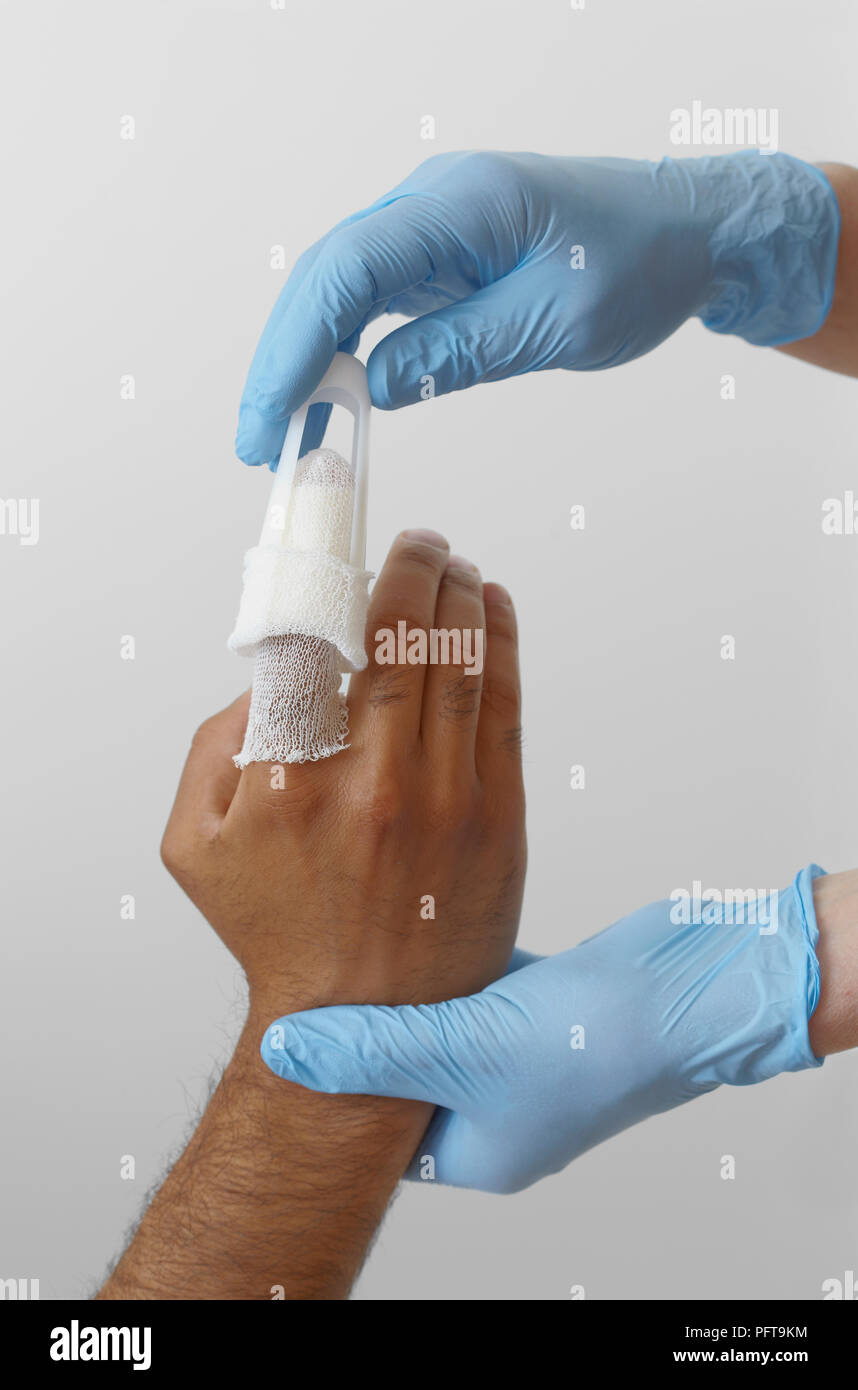 Tratamiento de primeros auxilios de lesiones de dedo, aplicando el vendaje de gasa tubular Foto de stock