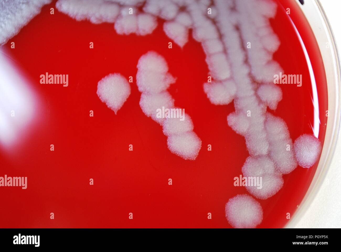 Fotografía en primer plano de una caja de petri que contiene una muestra de Bacillus anthracis (carbunco) colonias bacterianas, cultivadas en un medio de agar sangre de oveja (SBA) para un período de tiempo de 24 horas, Imagen cortesía de CDC/Megan Mathias y J Todd Parker, 2009. () Foto de stock
