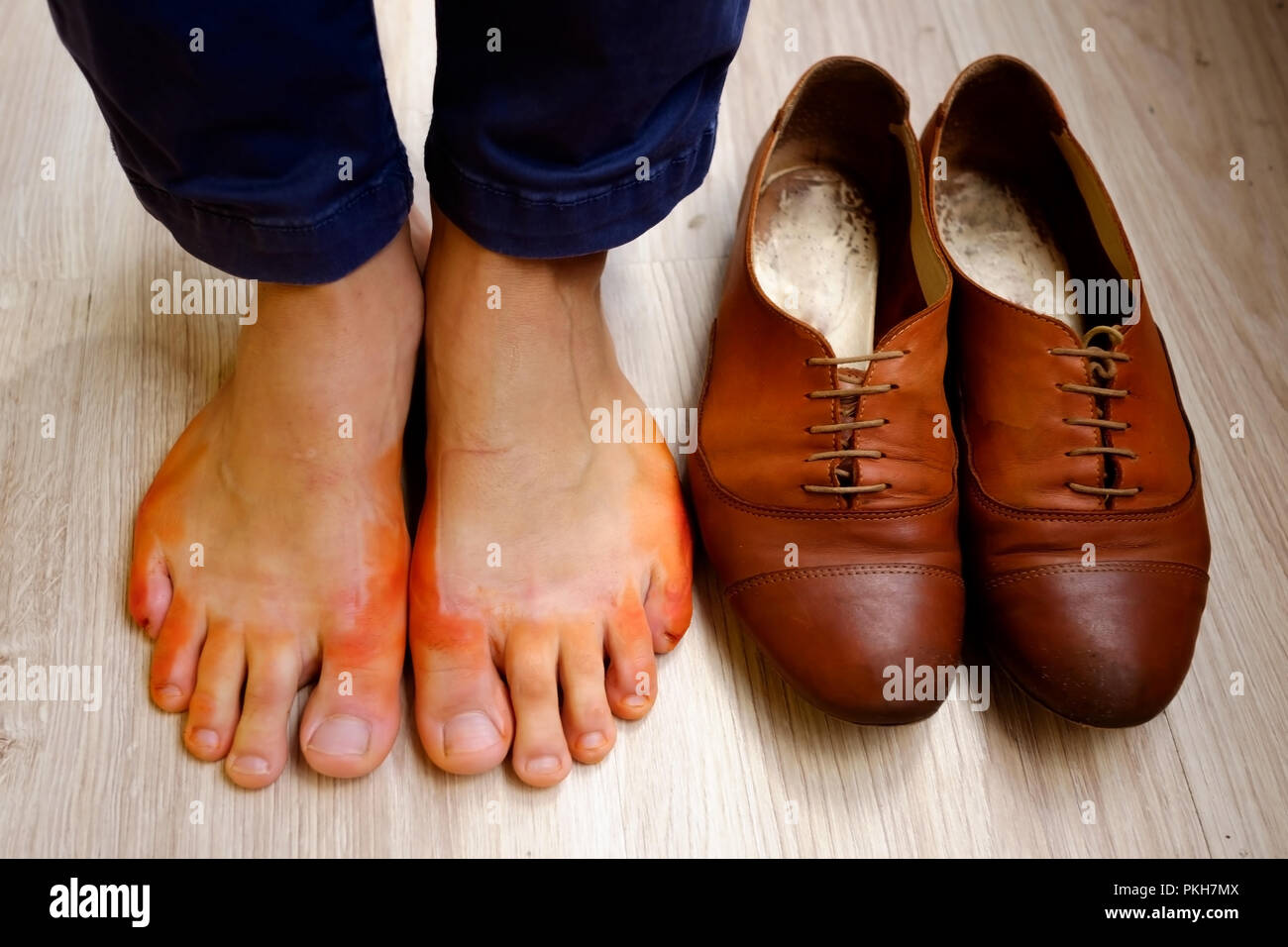 Mujer piel de pies se tiñe de color naranja con zapatos mojados Fotografía  de stock - Alamy