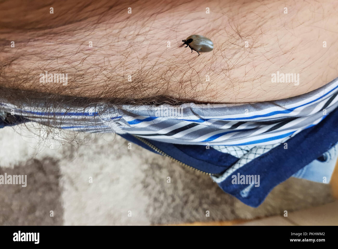 Garrapata Ixodes ricinus sobre derechos de la piel en el área genital. Caminar sobre el cuerpo humano. Encefalitis por garrapata, este tipo de animal es un esparcidor de Borrelia Foto de stock