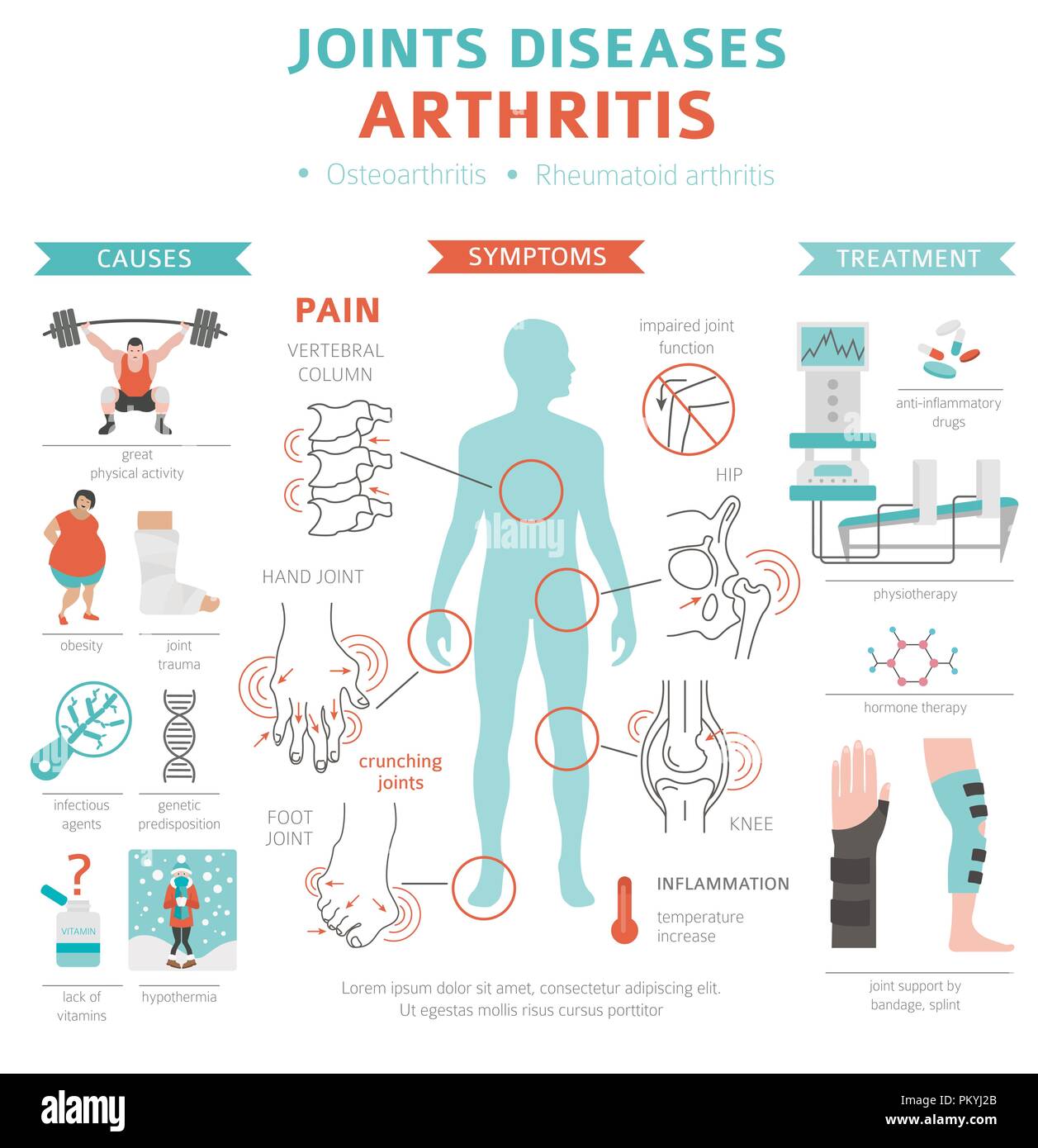 Enfermedades de las articulaciones. Los síntomas de la artritis, el