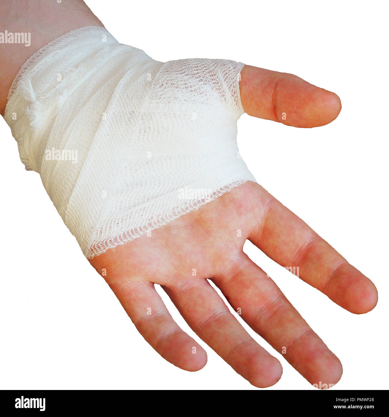 Doloroso mano lesionada con vendaje de gasa blanca sobre fondo blanco  Fotografía de stock - Alamy