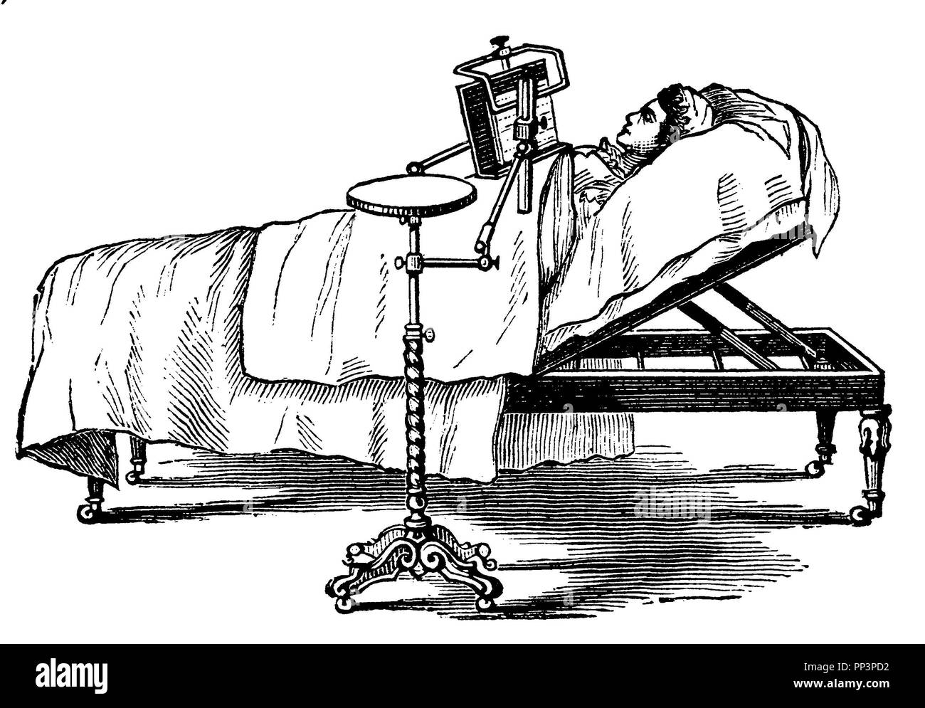 English La cama de un hospital con un atril, anonym 1887 Foto de stock