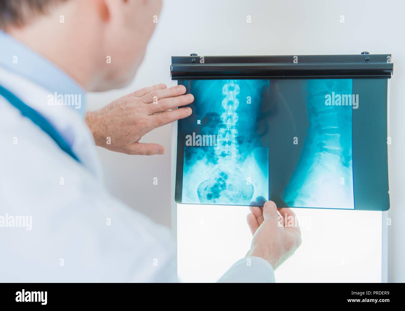 Médico del Cáucaso en su 50s Comprobación de imágenes de rayos x. Radiografía Digital. Tema de salud. Foto de stock