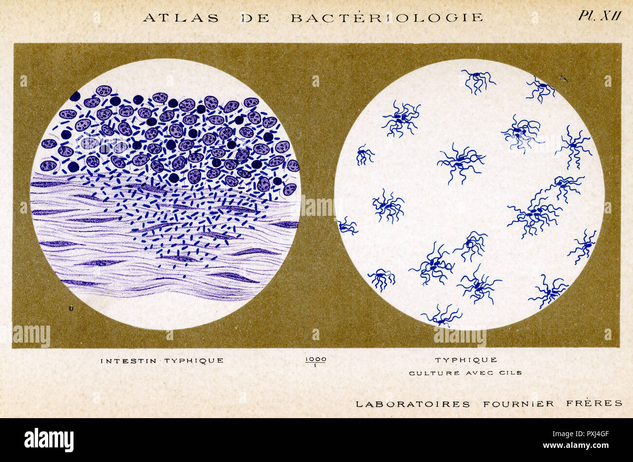 Tifus bacillus, descubierto por Eberth, 1880, y estudiado por Gaffky, 1884 - - izquierda, derecha - intestino infectado, cultura Foto de stock