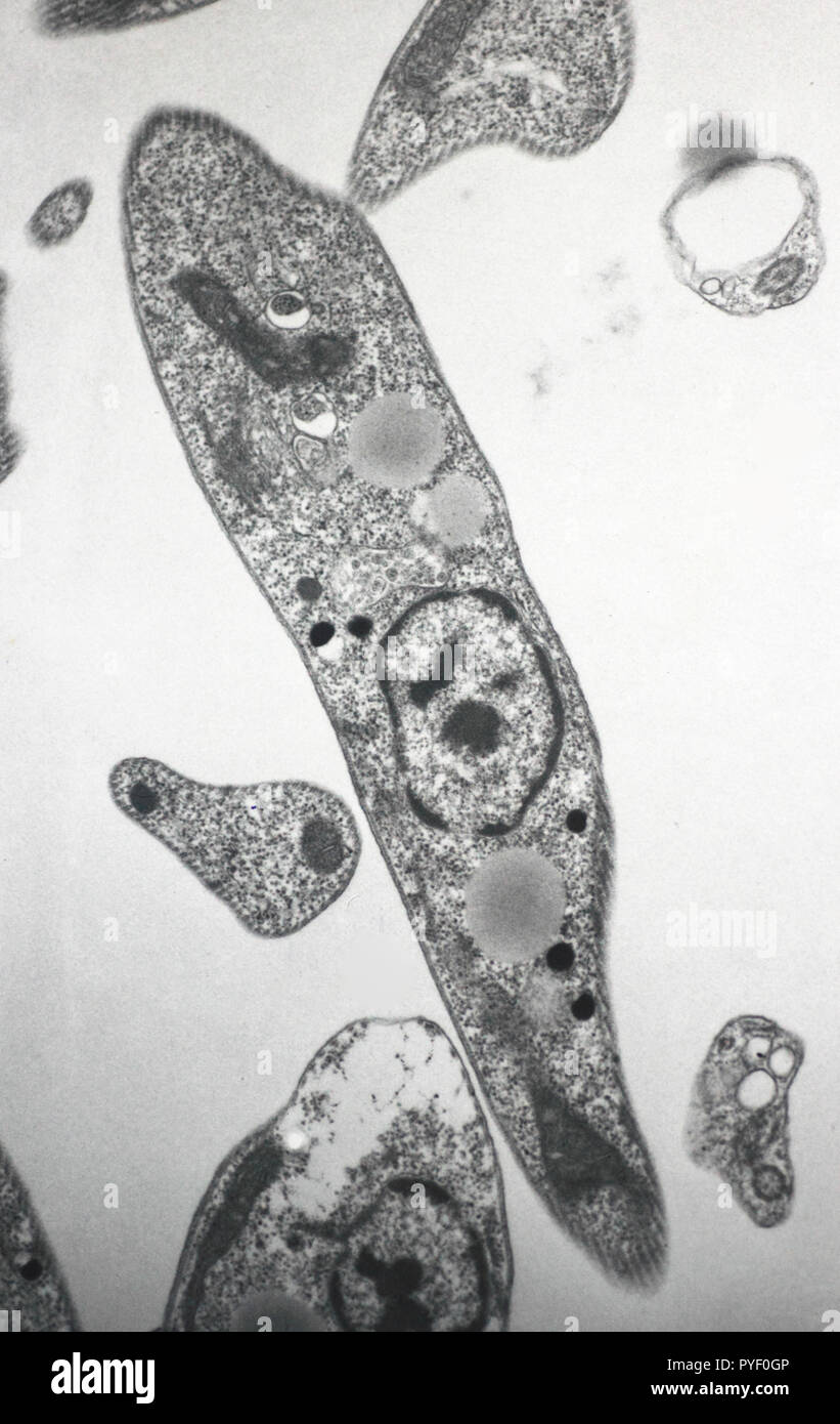 Microscopía electrónica de tripanosoma Foto de stock
