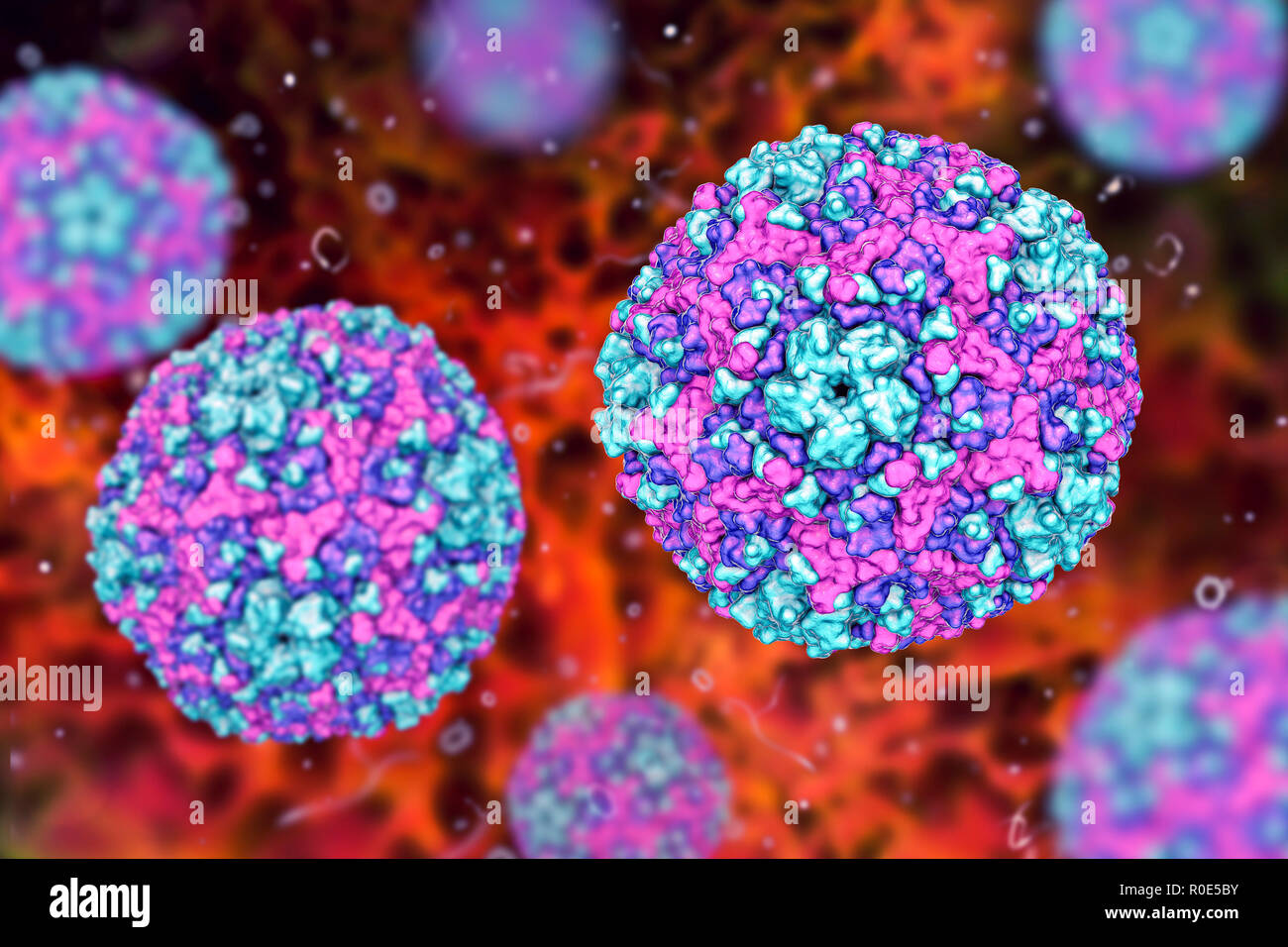 Bornholm disease fotografías e imágenes de alta resolución Alamy