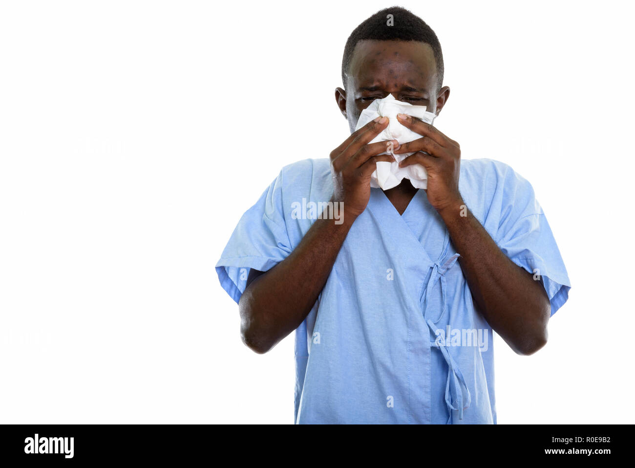 Foto de estudio de la joven paciente hombre negro africano sopla su nariz Foto de stock