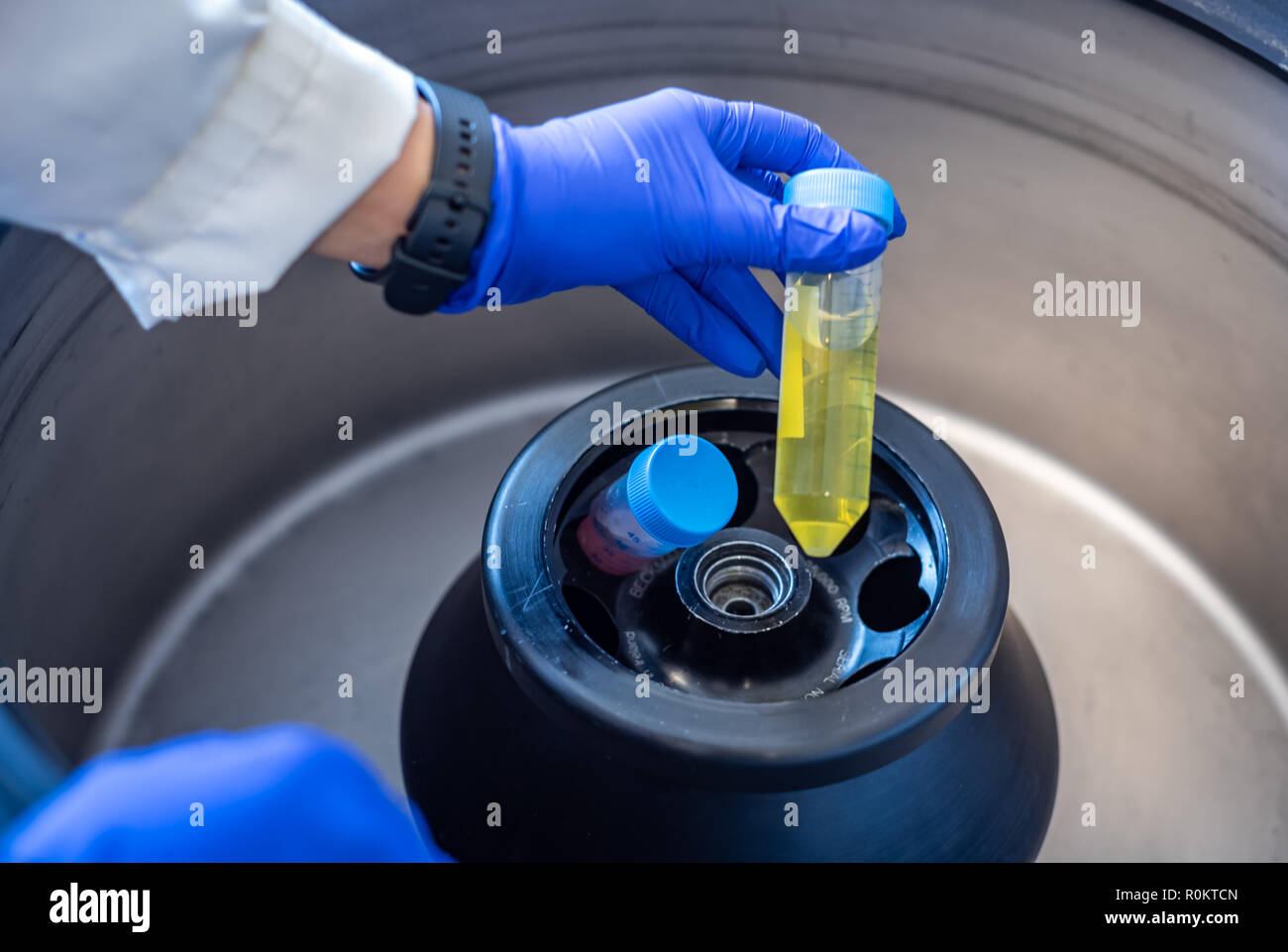 La centrifugación de muestras biológicas en el laboratorio biomédico Foto de stock