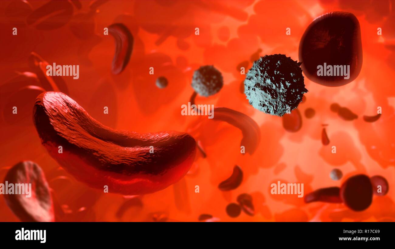 La Anemia De Celulas Falciformes Ilustracion Que Muestra Globulos