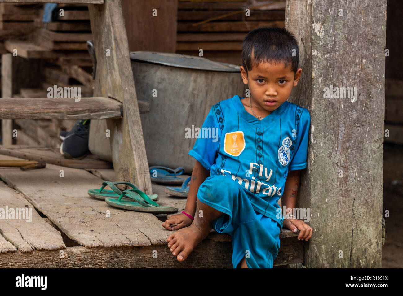 Resultado de imagen para imagen del niño pobre y descalzo