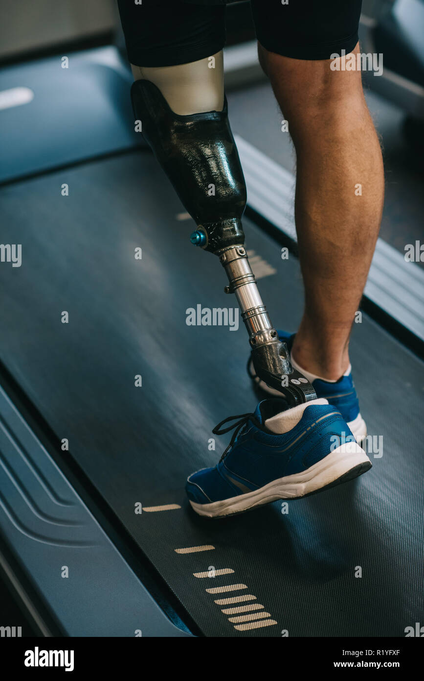Captura recortada del deportista con la pierna artificial caminar sobre el  tapiz rodante en el gimnasio Fotografía de stock - Alamy