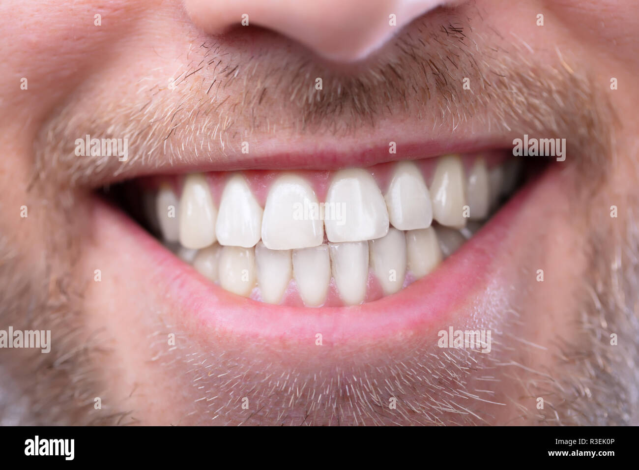 Close-up de un hombre feliz con dientes sanos Foto de stock