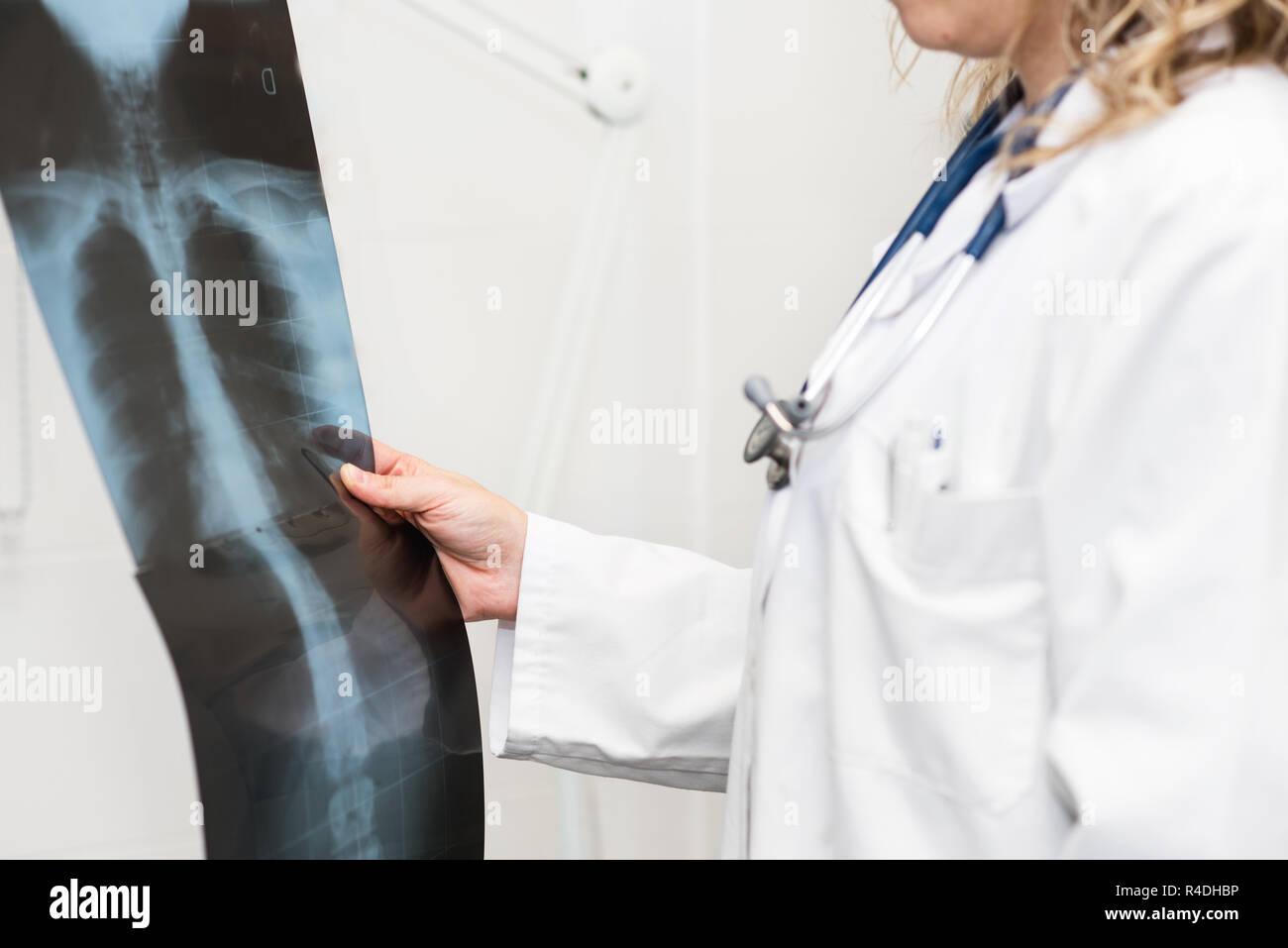 Doctora examinando una radiografía Foto de stock
