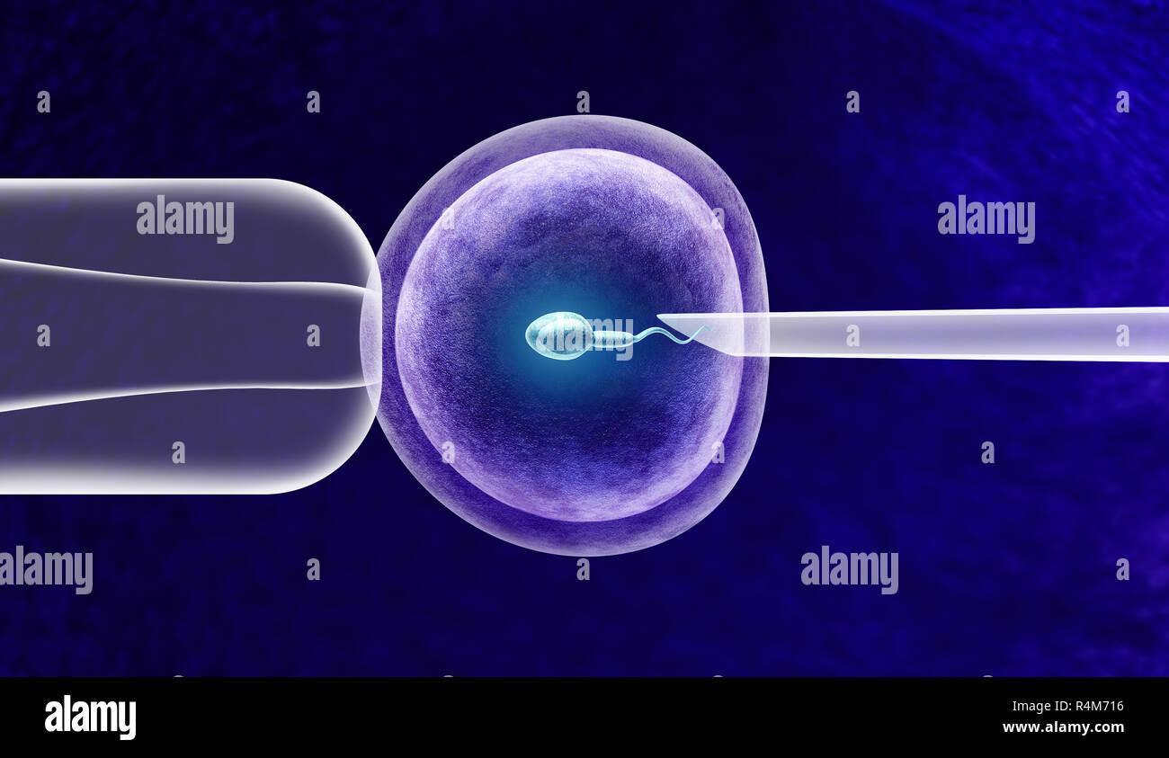 La fertilización in vitro o FIV tratamiento de fertilidad e inseminación artificial con un óvulo y un espermatozoide humano ayudando con los temas de infertilidad. Foto de stock