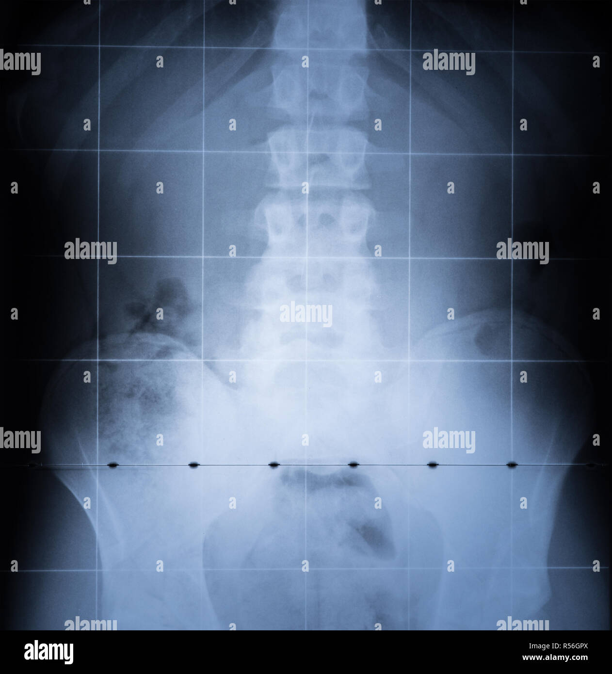 Radiología de pelvis fotografías e imágenes de alta resolución Alamy